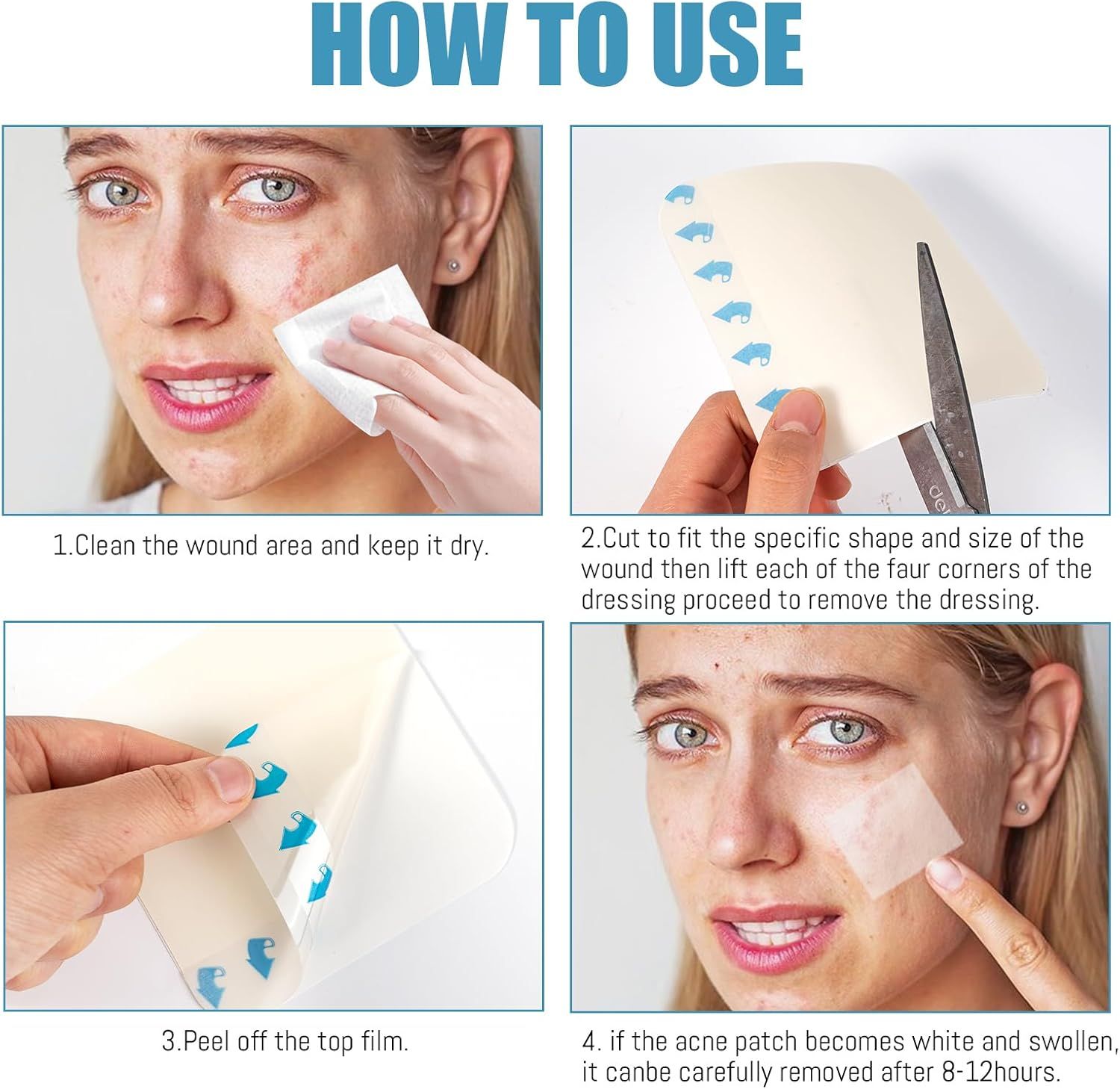 Quattro immagini mostrano l'applicazione di medicazioni. Passaggi: Pulire, tagliare, staccare, rimuovere. Donna con acne.
