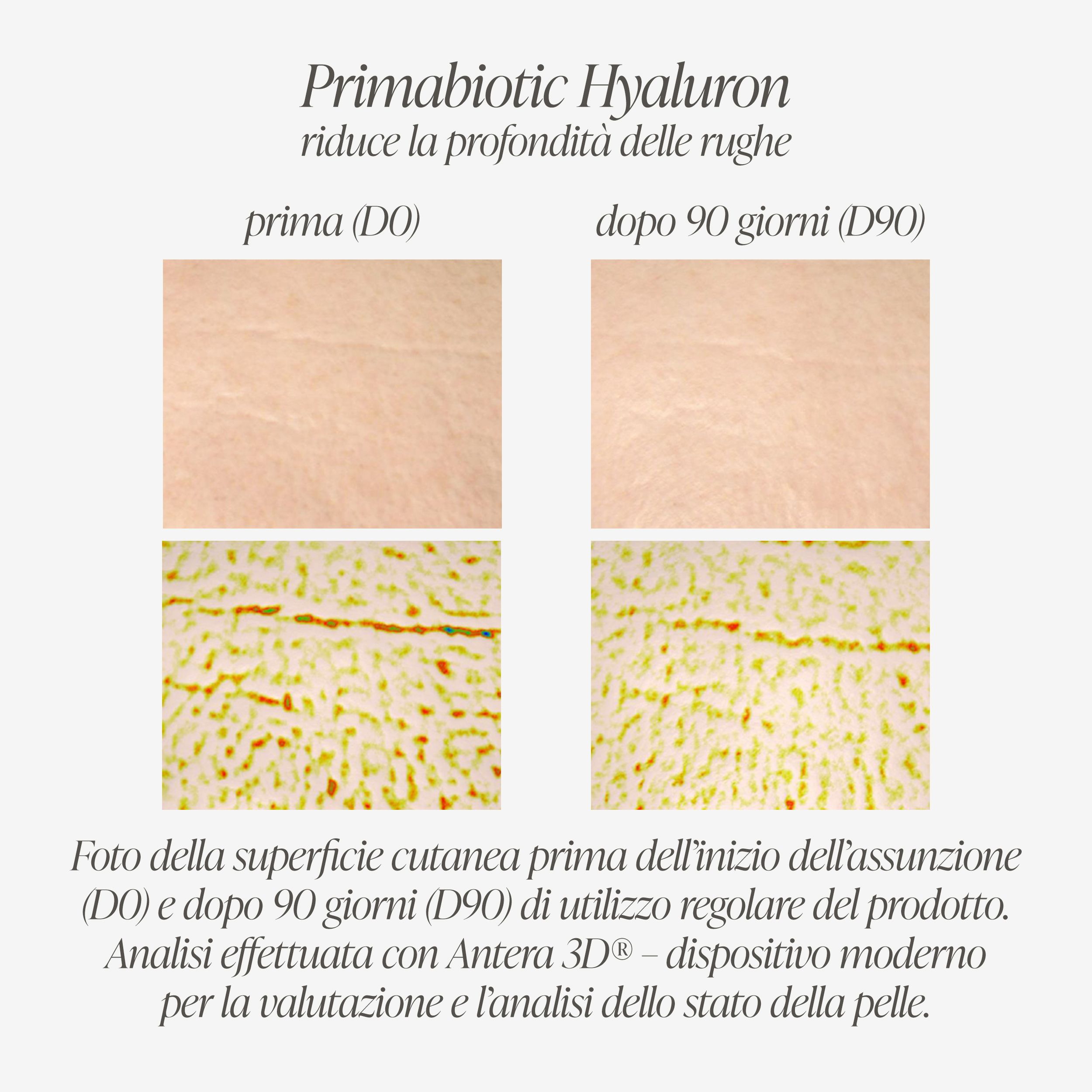 Primabiotic Hyaluron Shot: Analisi cutanea prima e dopo 90 giorni di utilizzo.