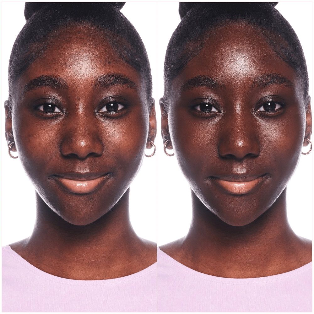 Confronto prima e dopo. Viso di una persona prima e dopo l'applicazione del fondotinta.