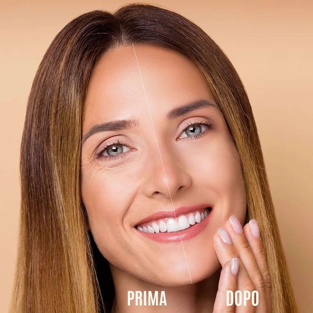 Confronto prima-dopo. Donna con rughe, poi pelle liscia. Testo: Prima, Dopo.
