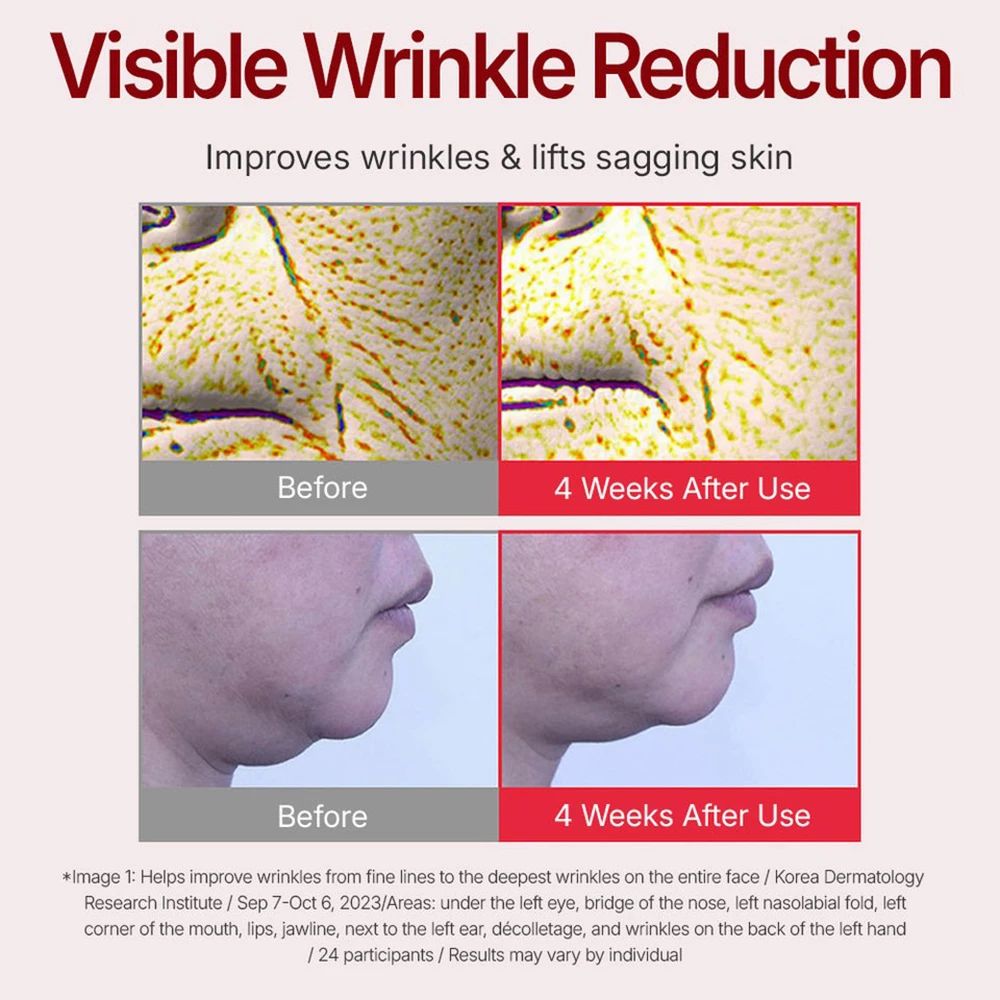 Immagini prima/dopo della pelle. Testo: Visible Wrinkle Reduction. Testo: Improves wrinkles & lifts sagging skin. Sfondo rosso.