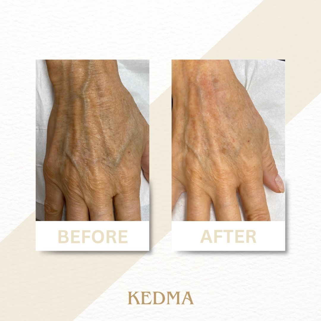 Kedma - Crema Mani con Minerali del Mar Morto