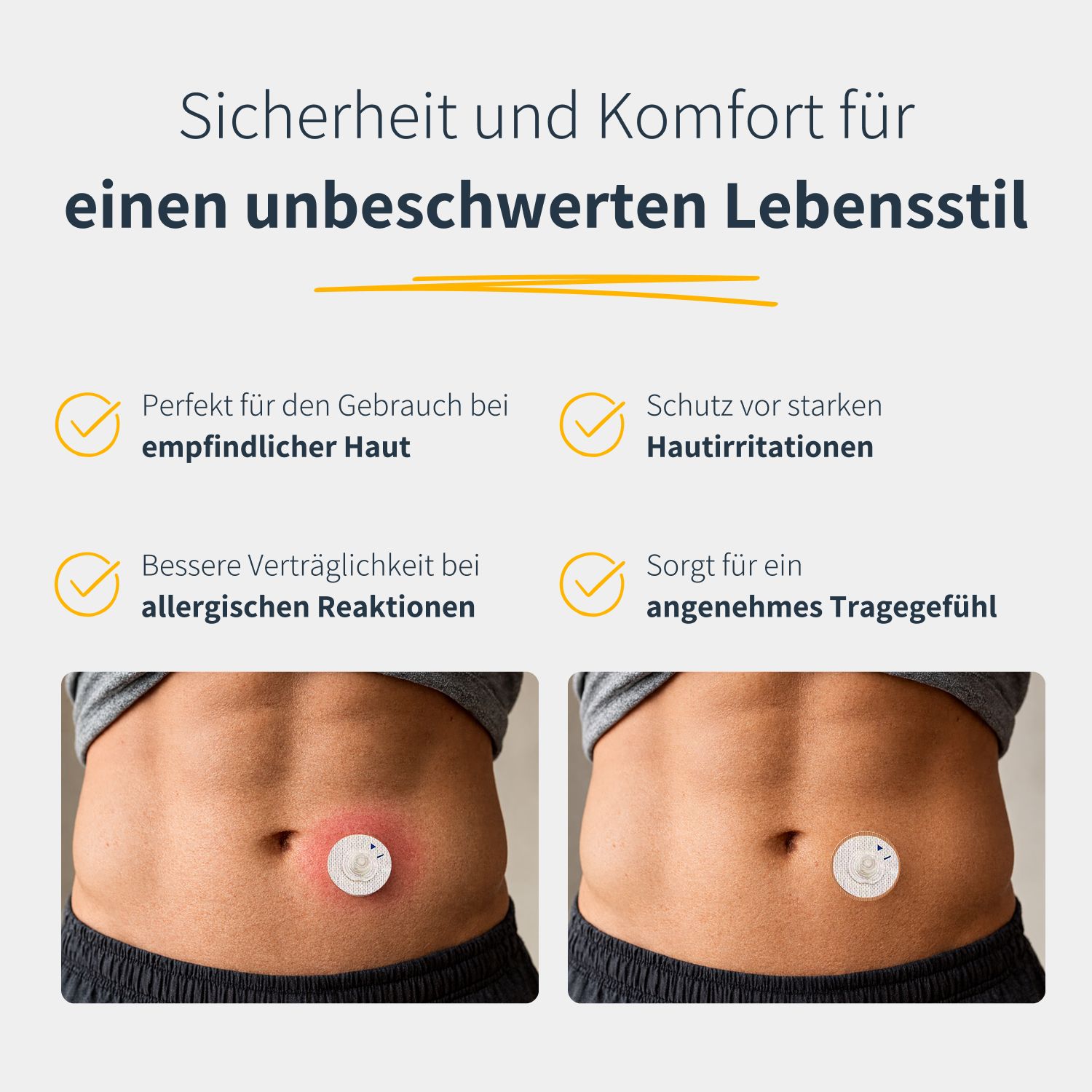 Vista addominale con cerotto per catetere. Sinistra: arrossamento. Destra: cerotto senza arrossamento. Testo: sicurezza e comfort.