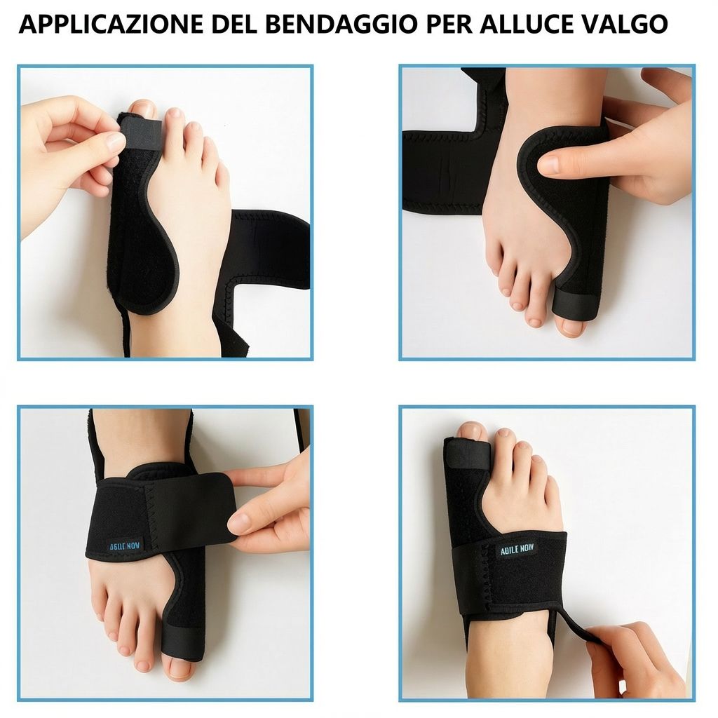 Applicazione del tutore Hallux Valgus. Quattro immagini mostrano l'applicazione del tutore sul piede. Testo: AGILE NOW.
