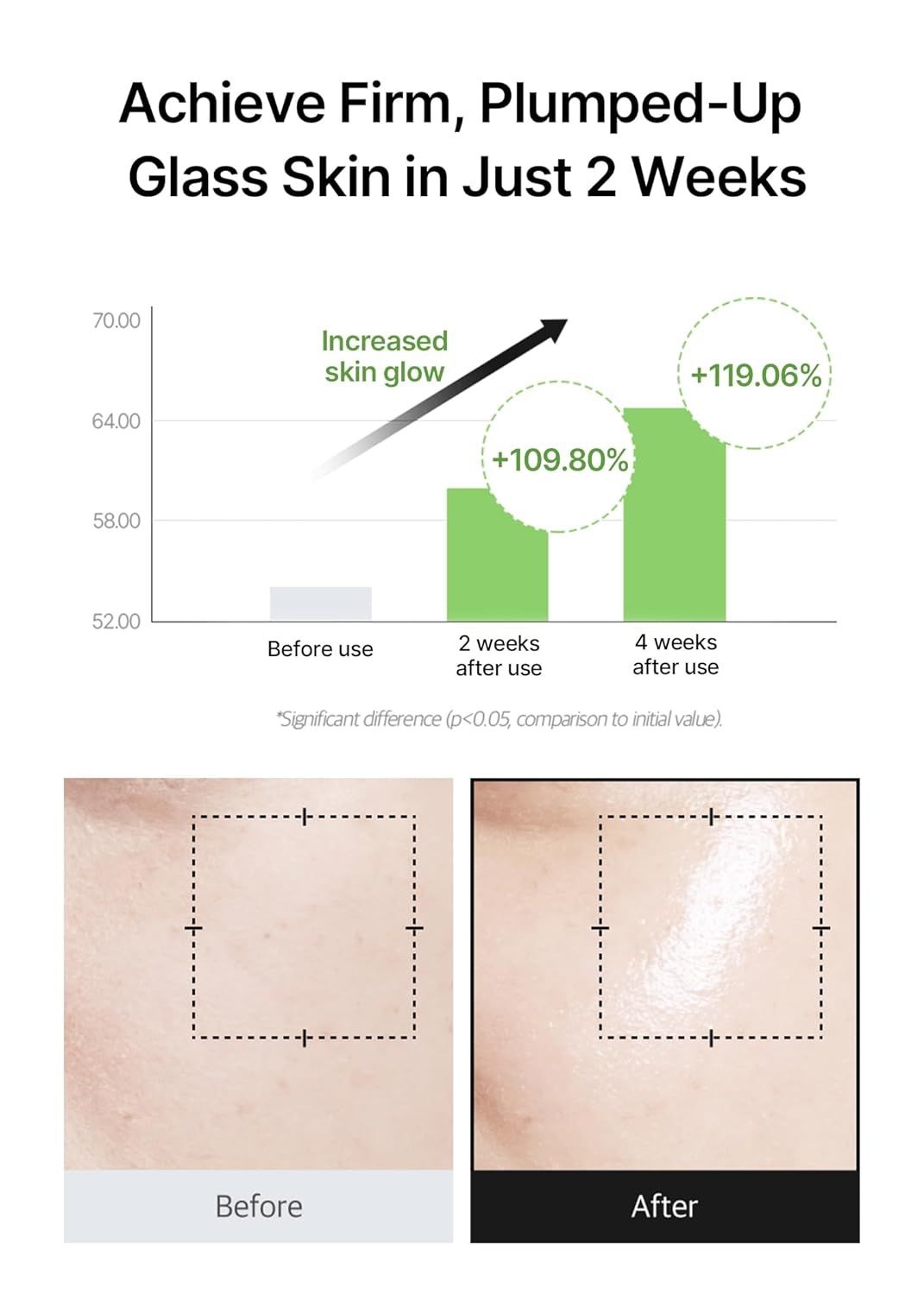 Grafico a barre che mostra i cambiamenti della pelle. Testo: Increased skin glow. Immagini prima/dopo della pelle. Percentuali.