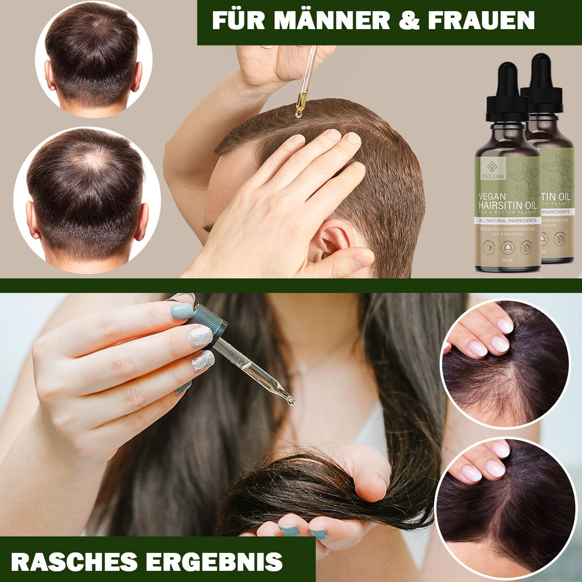 Uomini e donne. Esempi di caduta dei capelli. Due flaconi. Applicazione con pipetta. Risultato rapido. Testo in tedesco.