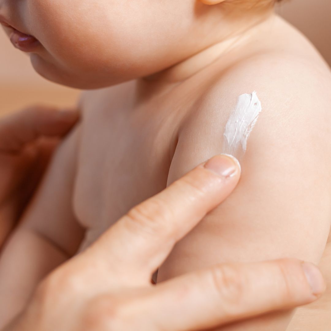 Primo piano di un bambino. Un dito applica la crema sulla spalla del bambino.