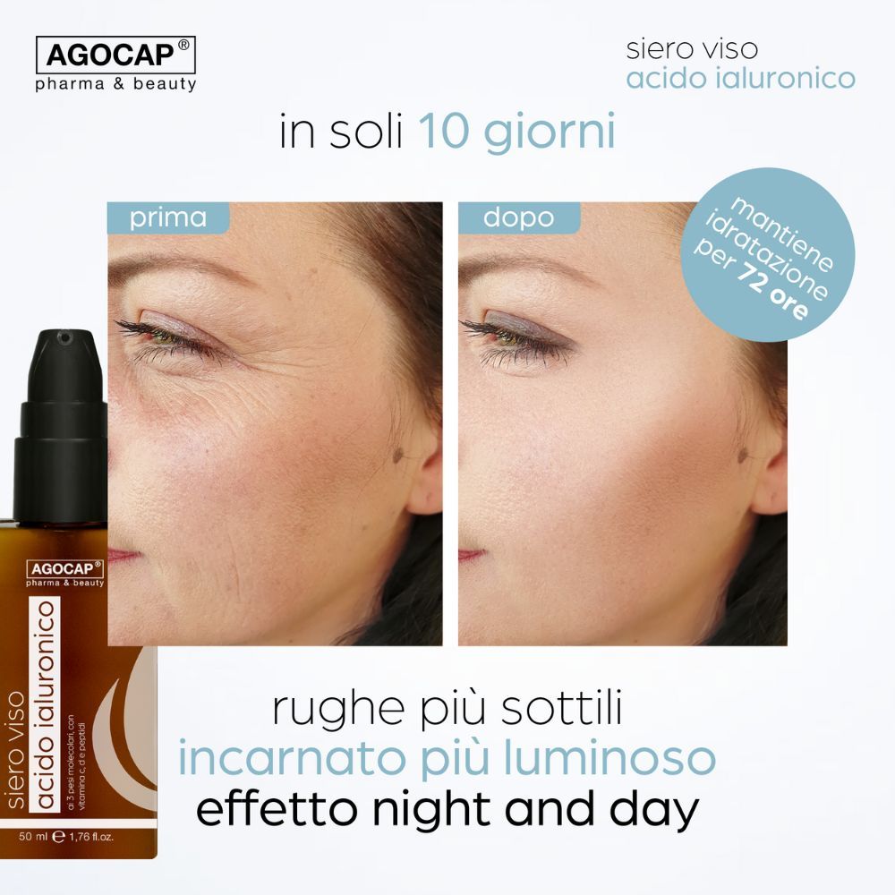 Confronto prima-dopo della pelle del viso. Flacone di siero a sinistra. Testo: In 10 giorni, rughe più lisce, incarnato più luminoso.