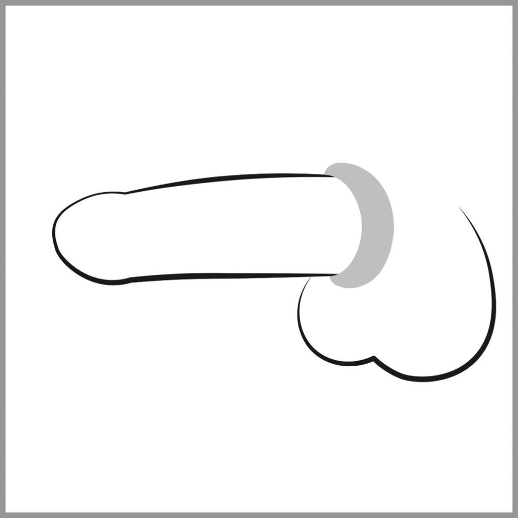Illustrazione in bianco e nero di un pene con un anello sullo stelo.