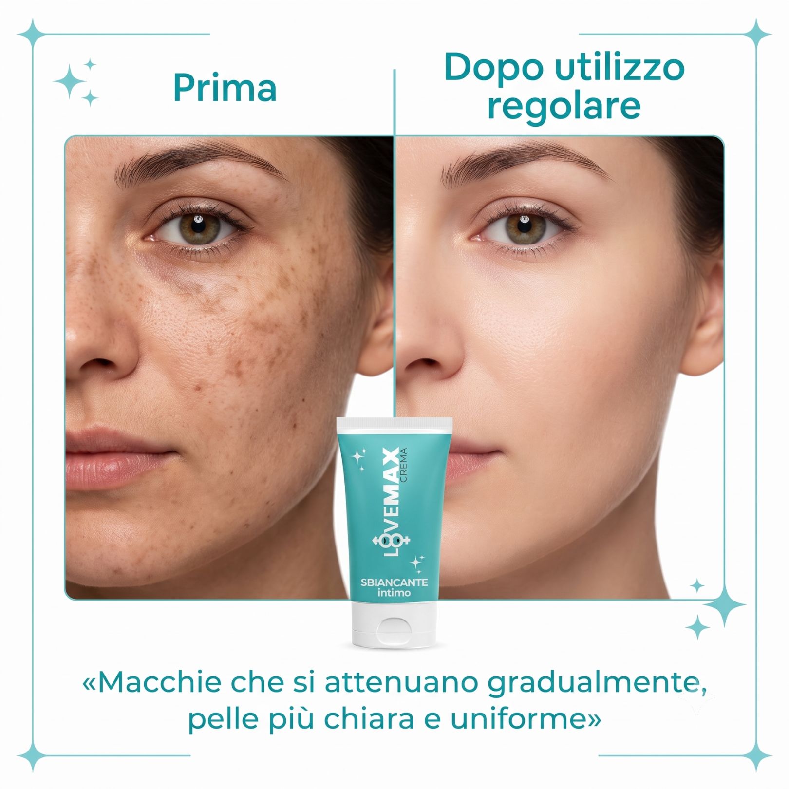 Confronto prima/dopo: viso con macchie e dopo l'uso della crema LOVEMAX Sbiancante Intimo.