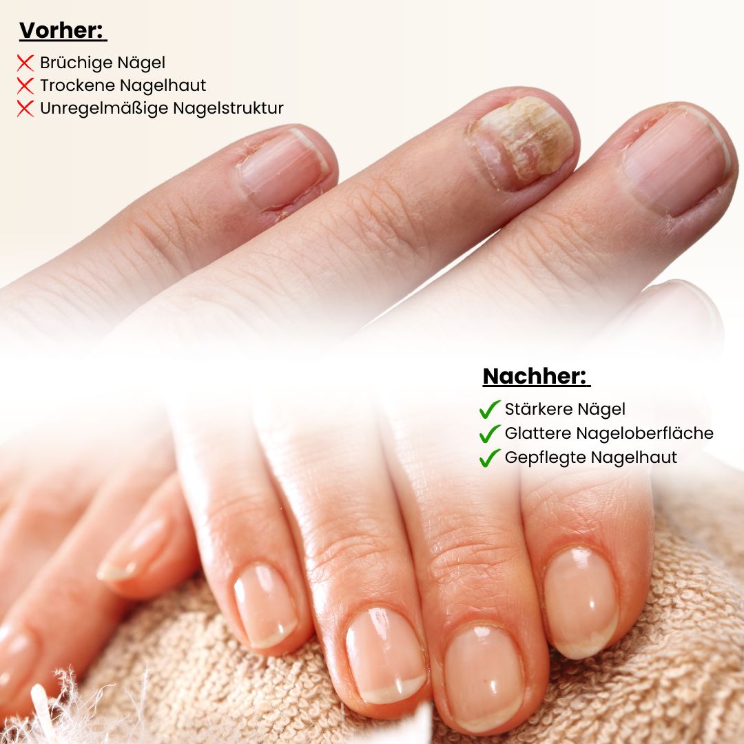 Confronto prima-dopo delle unghie. A sinistra: unghie fragili. A destra: unghie più forti, superficie più liscia, cuticole curate.