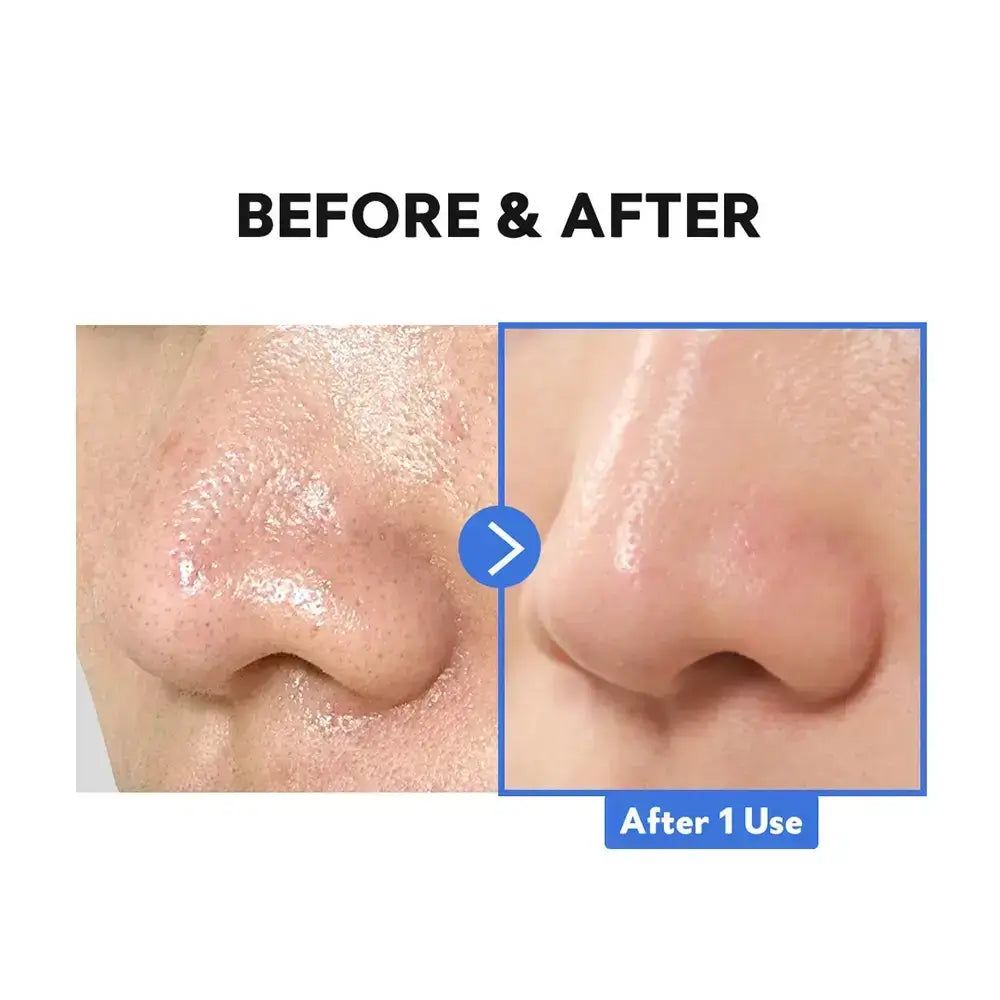 Confronto prima e dopo dei pori del naso, affinati dopo l'uso di TIRTIR Hydro Boost Enzyme Cleansing Balm.