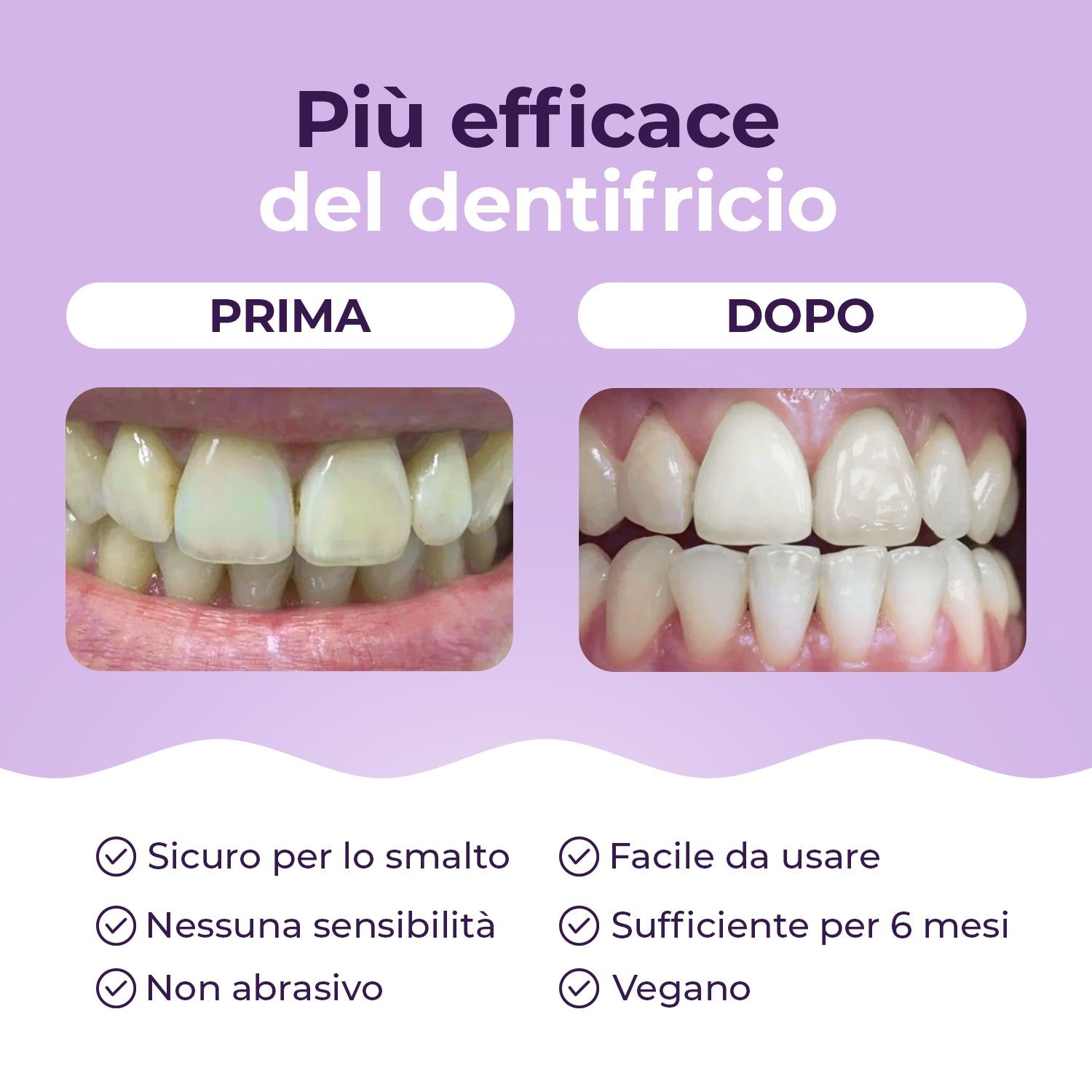 OnlySmile® Polvere per sbiancare i denti