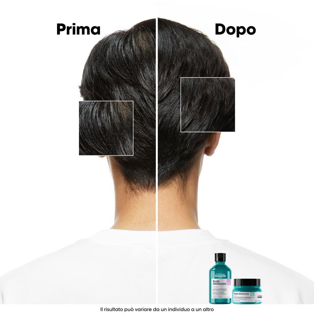 Confronto prima-dopo. Capelli prima e dopo l'uso. In basso: flacone e vasetto. Testo: Prima, Dopo.