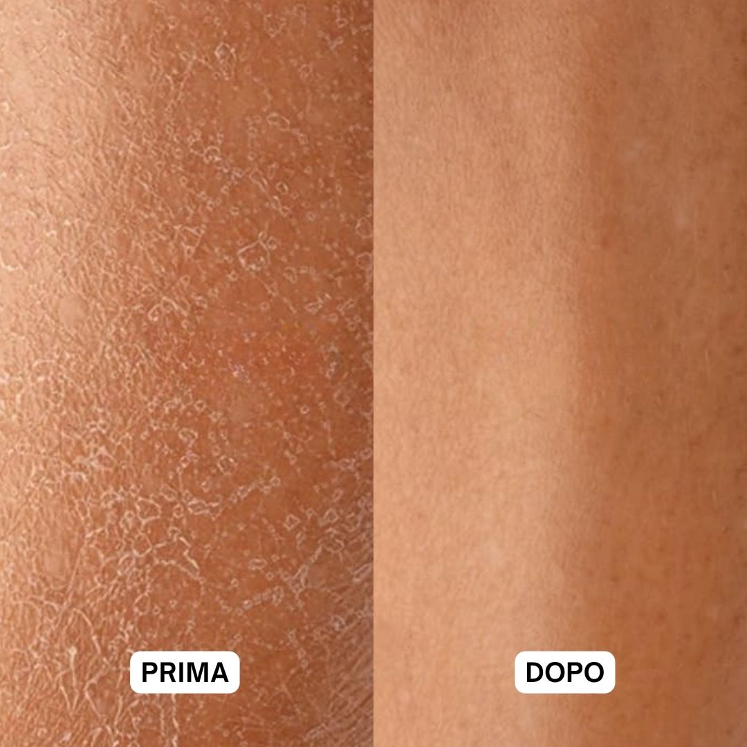 Confronto prima-dopo. Pelle secca prima dell'uso. Pelle liscia dopo l'uso.