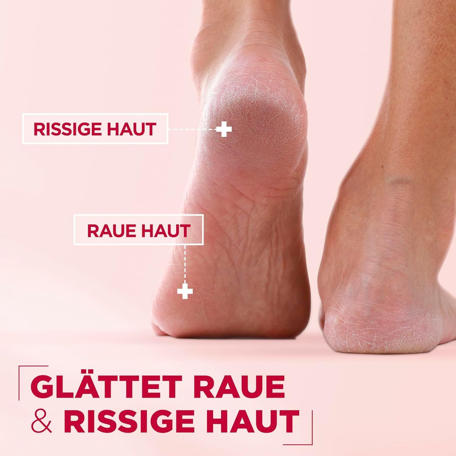 Primo piano dei piedi. Testo: Pelle screpolata, pelle ruvida. Testo: Leviga la pelle ruvida e screpolata.