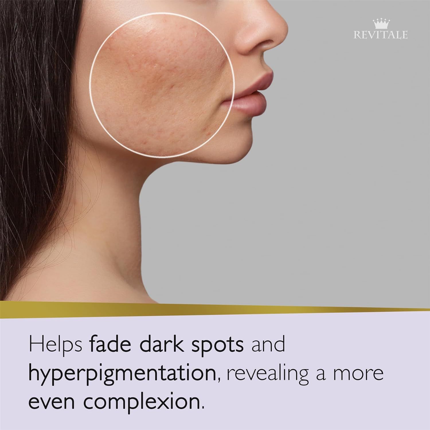 Profilo di una donna con imperfezioni cutanee. Testo: Aiuta a ridurre le macchie scure e l'iperpigmentazione.