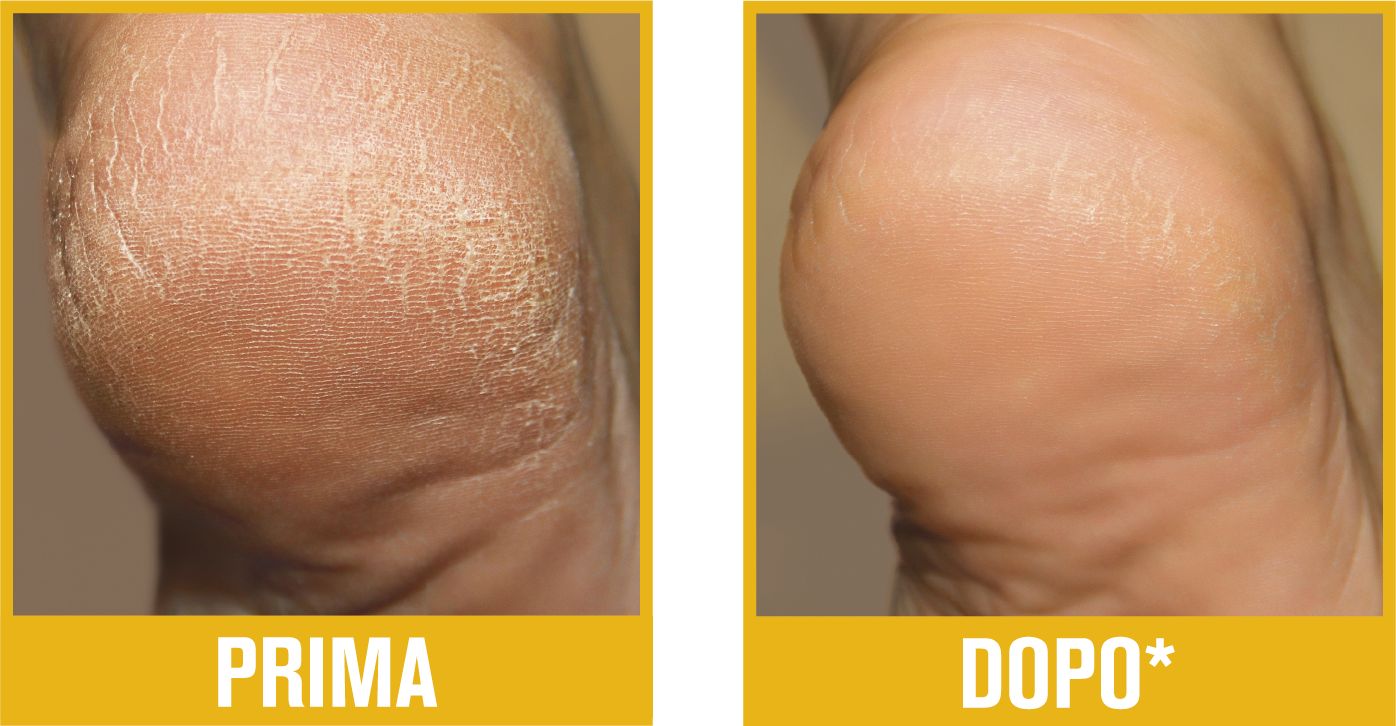 Podovis Crema Riduci e Previeni Callosità 60 ml