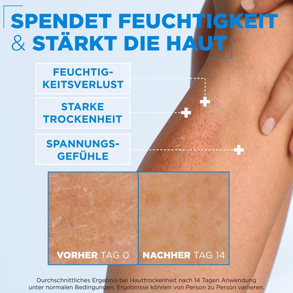 Gamba con pelle secca. Grafico che mostra il miglioramento dopo 14 giorni di utilizzo. Testo: Prima, Dopo, perdita di idratazione, secchezza intensa, tensione.