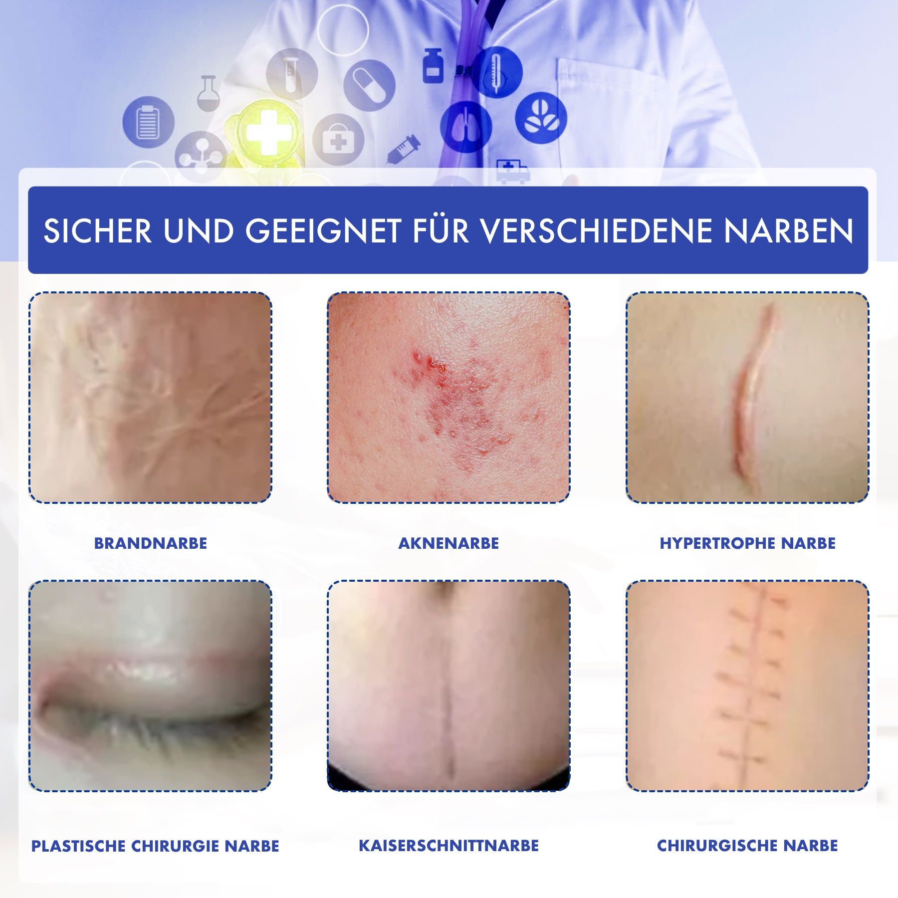 Diversi tipi di cicatrici. Testo: Cicatrice da ustione, cicatrice da acne, cicatrice ipertrofica, chirurgia plastica, cicatrice da taglio cesareo, cicatrice chirurgica.
