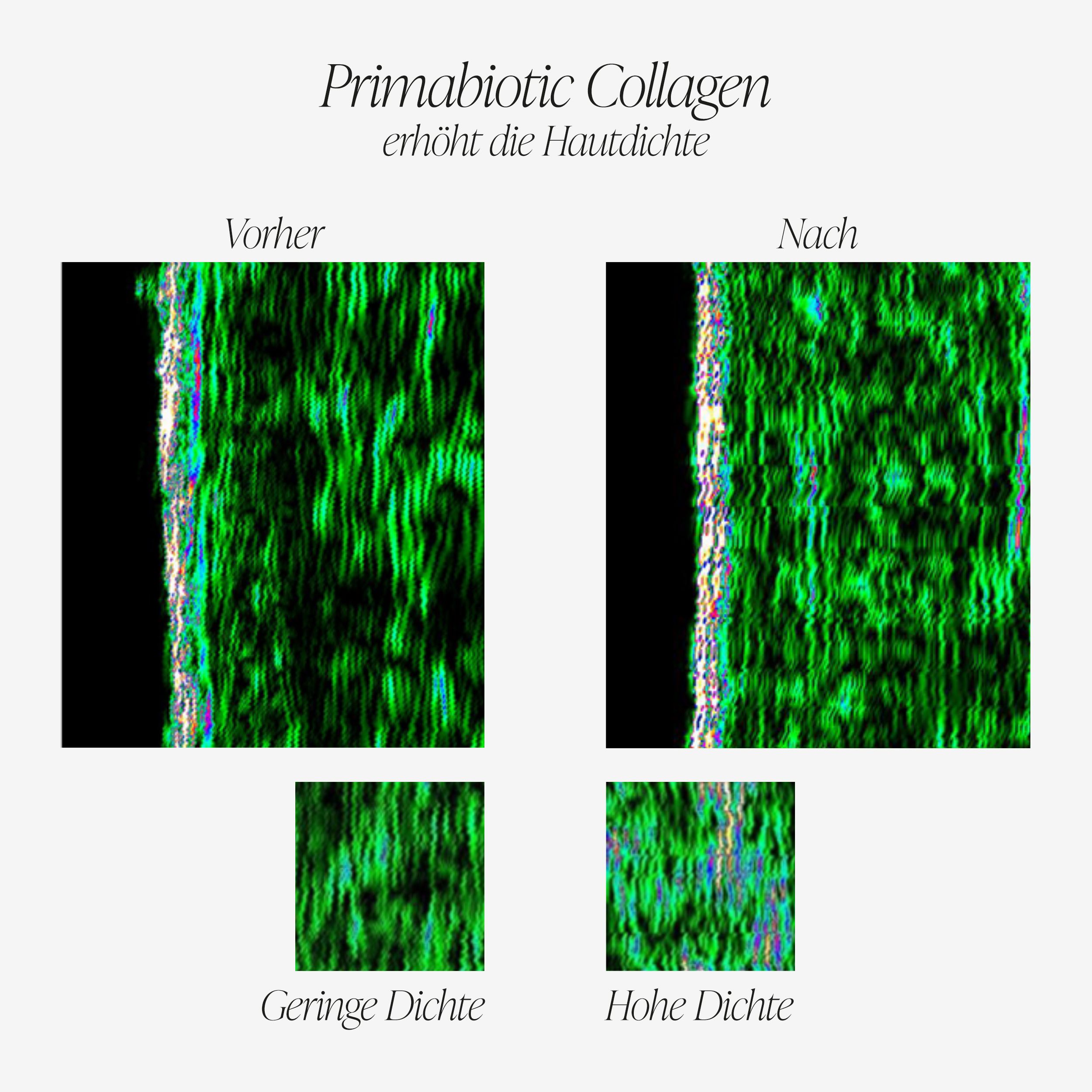 Confronto della pelle prima e dopo l'uso. Testo: Primabiotic Collagen aumenta la densità della pelle. Prima: bassa densità. Dopo: alta densità.