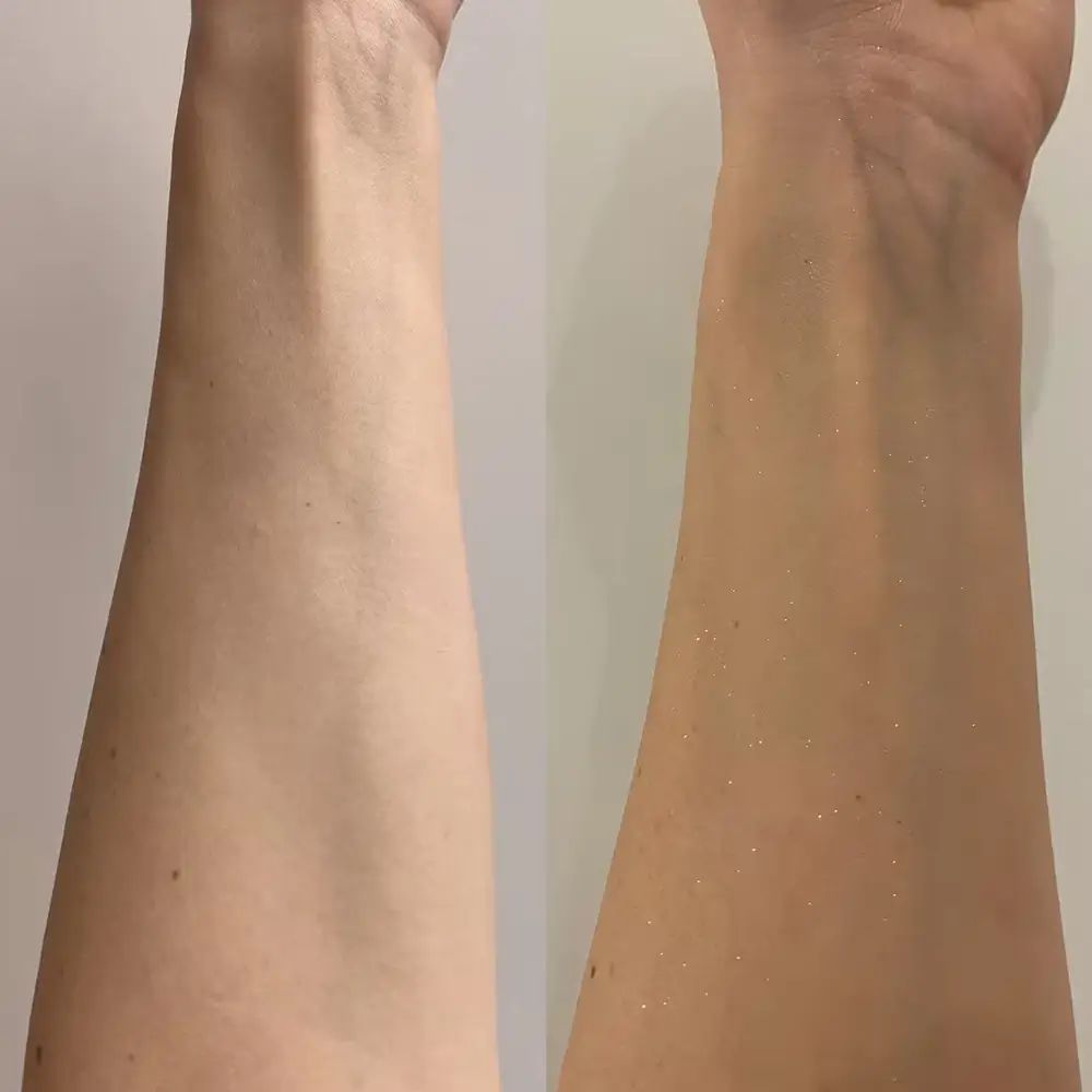 Due braccia affiancate. Uno non abbronzato, l'altro abbronzato con riflessi. Differenze di incarnato chiaramente visibili.