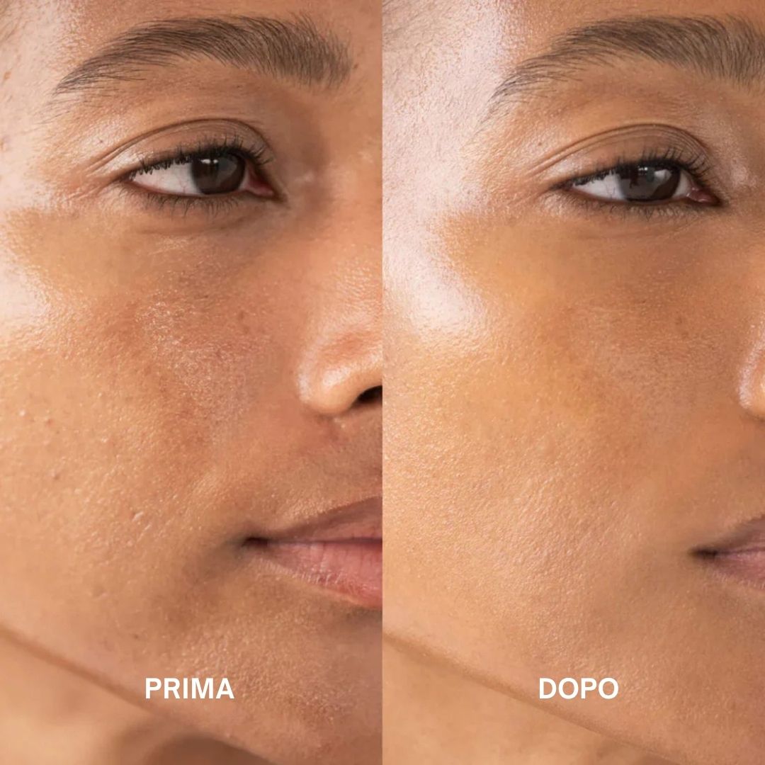 Immagine prima e dopo. Viso con imperfezioni, poi pelle liscia. Testo: Prima, Dopo.