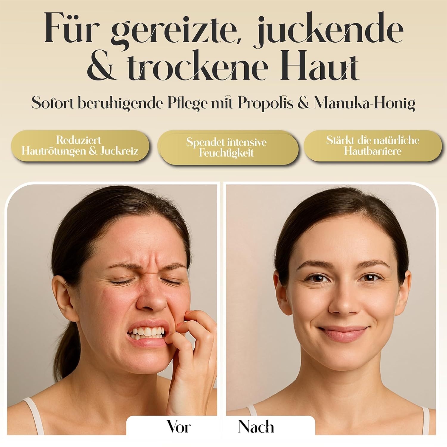 Prima-dopo. Donna si gratta, poi sorride. Testo: 'Für gereizte, juckende & trockene Haut'. Testo: 'Reduziert Hautrötungen & Juckreiz'.