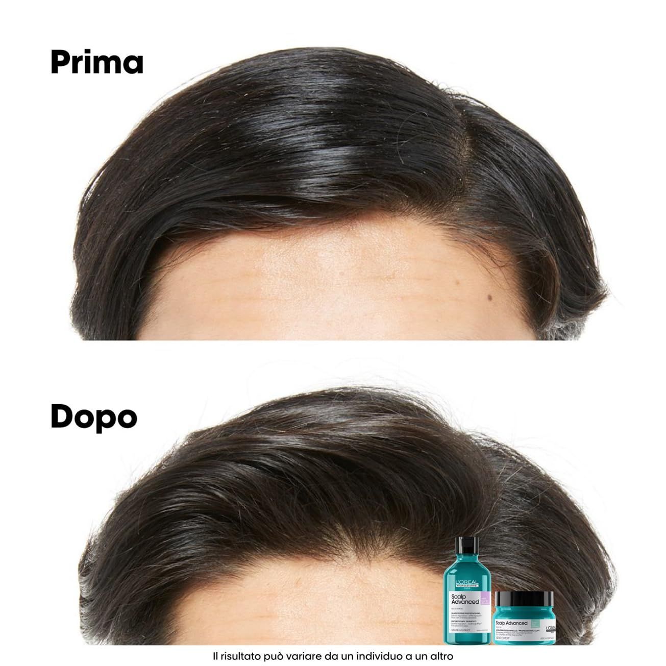 Confronto prima-dopo. Capelli prima e dopo l'uso. In basso: flacone e vasetto. Testo: Prima, Dopo.