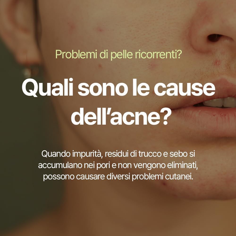 Primo piano di un viso. Testo: Quali sono le cause dell'acne? Quando impurità, residui di trucco e sebo si accumulano.