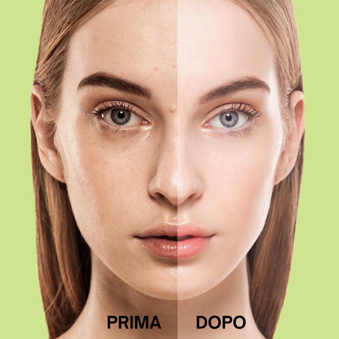Volto di donna diviso in prima e dopo. Differenze evidenti nell'aspetto della pelle.